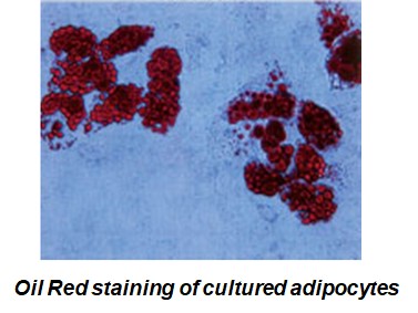 adipogenesis