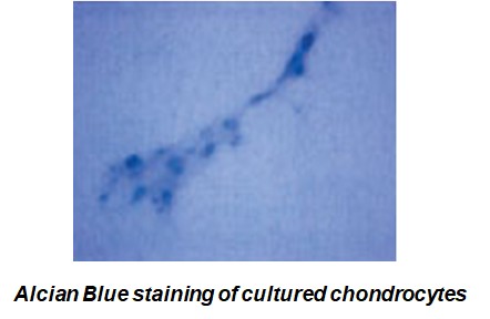 chondrogenesis