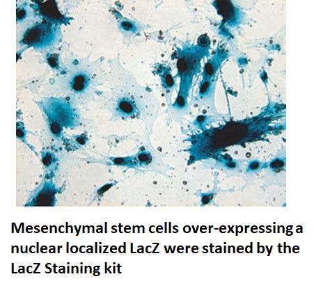 lacz staining